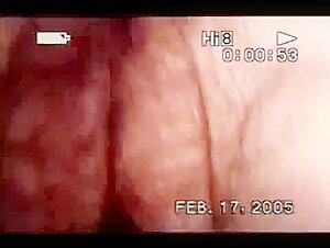 Extreme Sex Video with a Hairy Woman and a Dog
